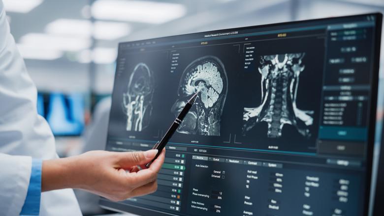 MSc Neuroscience of Mental Health